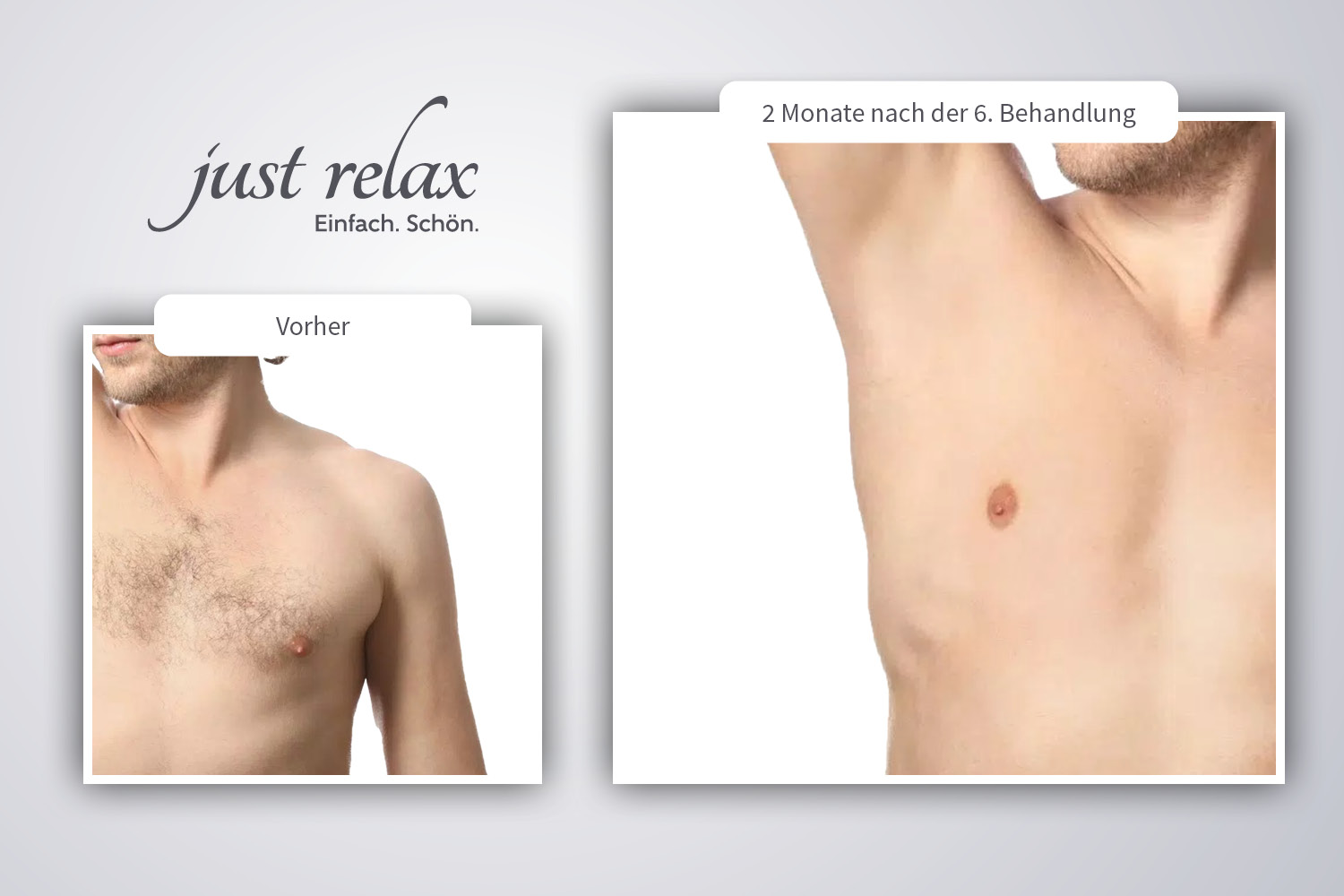 Schulter · 2 Monate nach 6. Behandlung